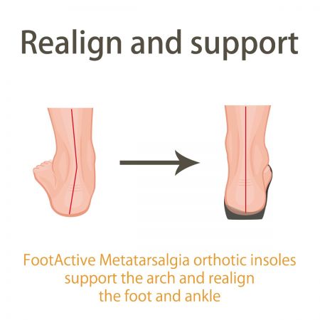 FootActive Metatarsalgia 3/4 Length Insoles Improve Foot and Ankle Positioning